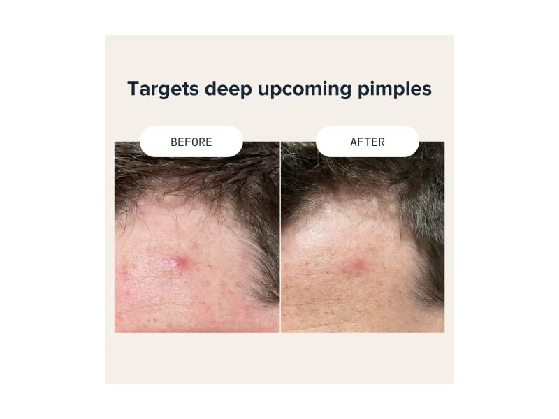 Cardon Prickly Patch, 9 Count