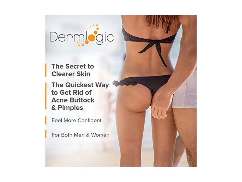 Dermlogic Anti-Acne Thigh & Buttocks Treatment 6.09 oz