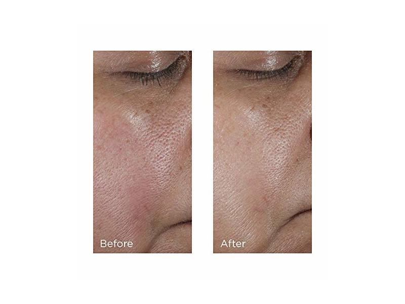 Perricone MD No: Rinse Intensive Pore Minimizing Toner, 4 fl oz/118 mL