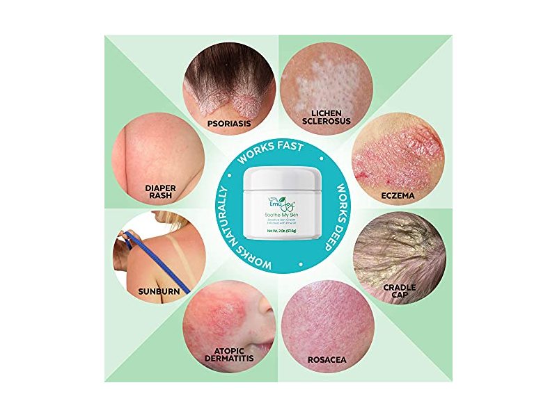 Emu Joy Soothe My Skin, 2 oz/57.6 g