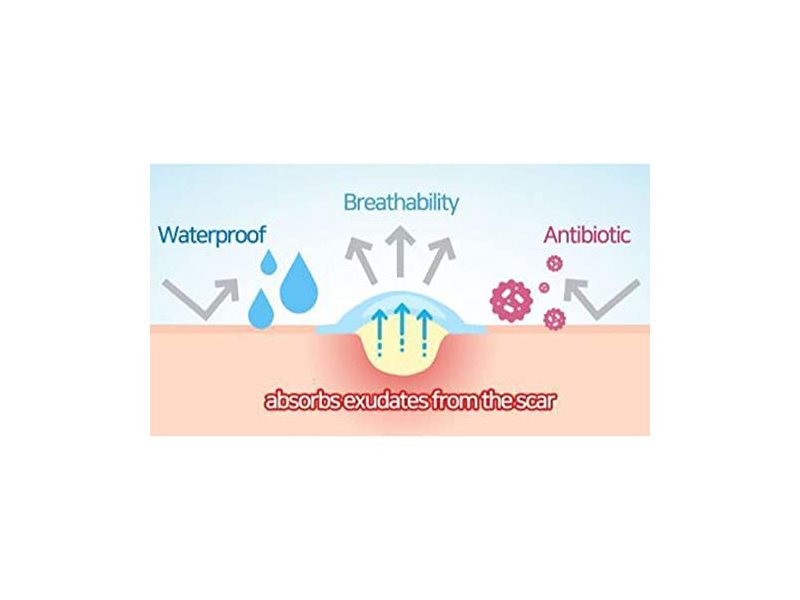 SOME BY MI 30 Days Miracle Clear Spot Patch - Pack of 1, 18 Counts e (10mm 9Counts, 12mm 9Counts) - Hydrocolloid Acne, Zit and Pimple Patches