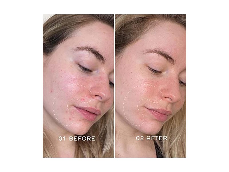 REN Clean Skincare Ready Steady Glow Daily AHA Tonic, 3.3 fl oz/100 mL