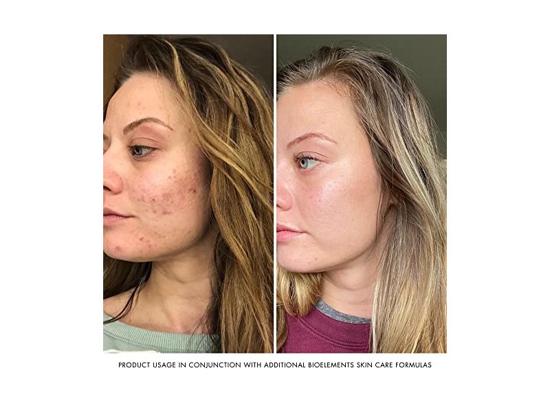 Bioelements RayDefense Sunscreen & Moisturizer, SPF 30, 4 fl oz/118 mL