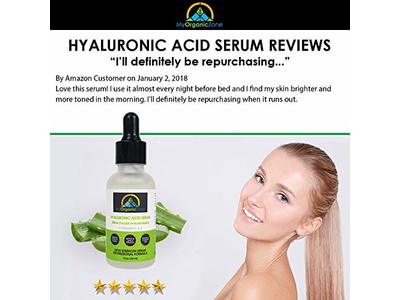 my organic zone retinol moisturizer