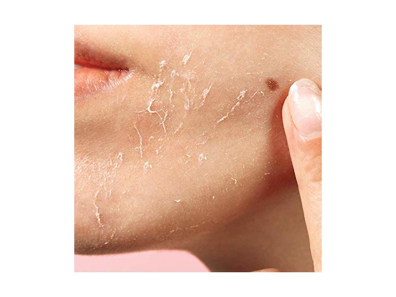 Odacite Pure Elements Bioactive Rose Gommage Baby Soft facial peel, Pineapple + Hyaluronic Acid, 1.69 fl oz / 50 mL