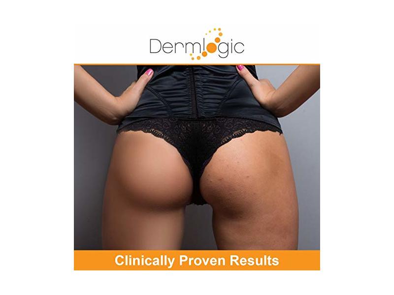 Dermlogic Anti-Acne Thigh & Buttocks Treatment 6.09 oz