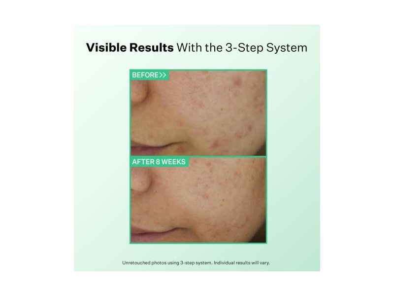 Strivectin Multi-Action Clear Gentle Daily Clarifying Cleanser, 5 fl oz/150 mL