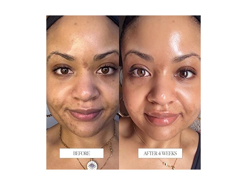 Byroe Celery AHA + LHA Resurfacing Serum, 1.01 fl oz/ 30 mL