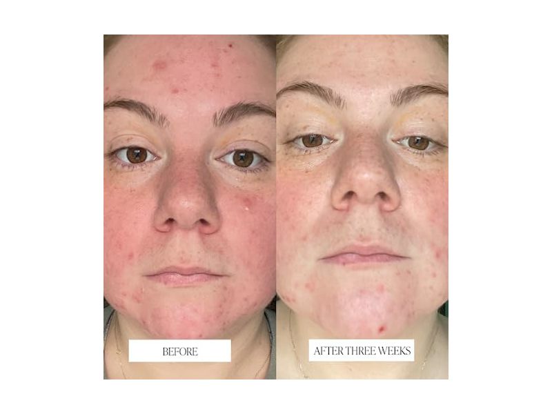 Byroe Celery AHA + LHA Resurfacing Serum, 1.01 fl oz/ 30 mL