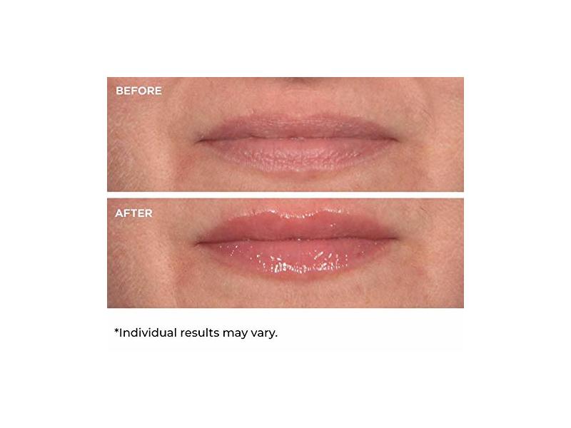 Nassifmd Hydro-Screen For Lips, Lip Hydrating And Volumizing Serum, 0.14 fl oz/4 mL