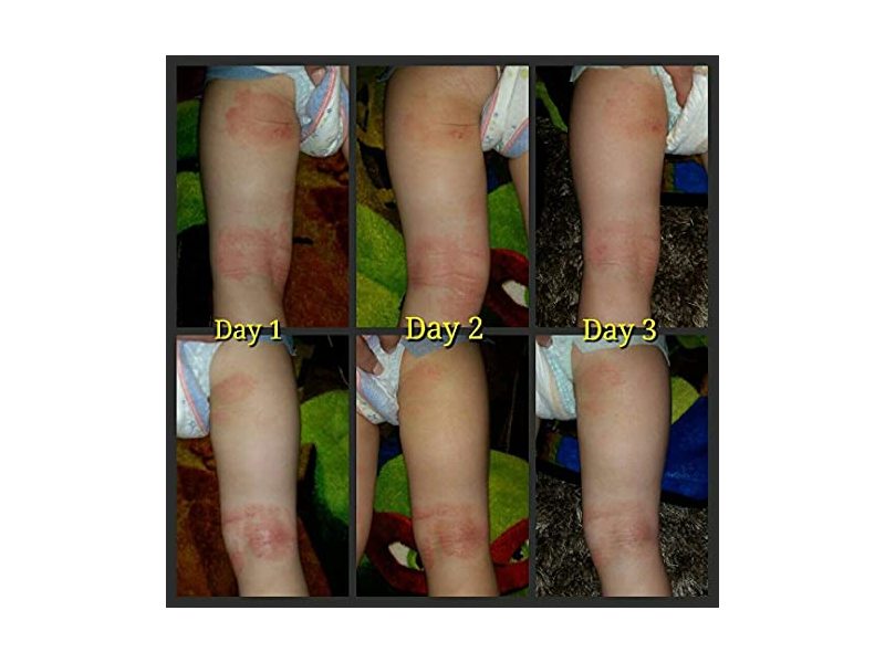 Emu Joy Soothe My Skin, 2 oz/57.6 g