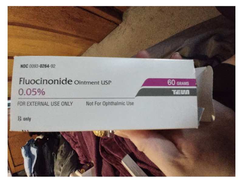 Fluocinonide Ointment 0.05%, 60 g, Teva Pharmaceuticals (RX)