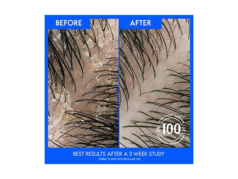 Head & Shoulders Dandruff Shampoo, Green Apple, 12.5 fl oz/370 mL