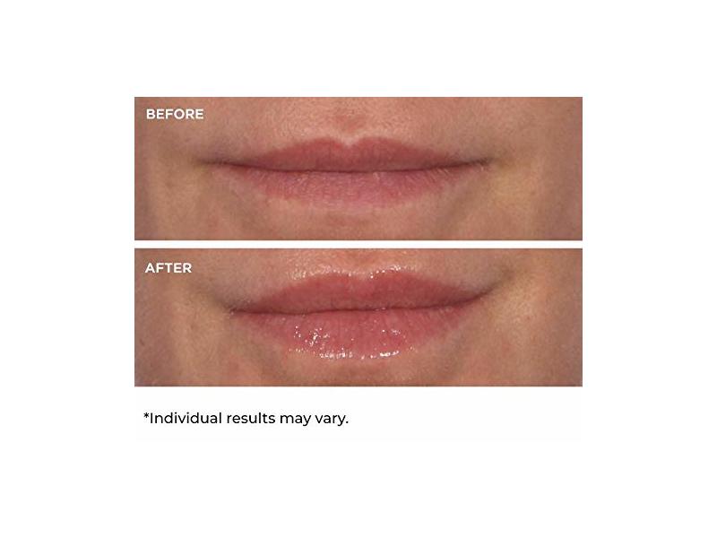 Nassifmd Hydro-Screen For Lips, Lip Hydrating And Volumizing Serum, 0.14 fl oz/4 mL