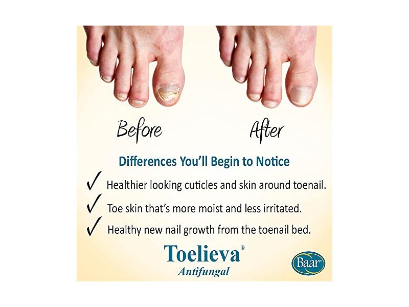 Baar Antifungal Toelieva Liquid Solution, 2 fl oz/60 mL